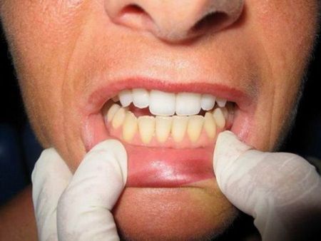 Un ingredient ieftin albeste dintii mai bine decat orice tratament scump