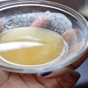 Bicarbonat de sodiu si miere, amestec care previne cea mai periculoasa boala din lume